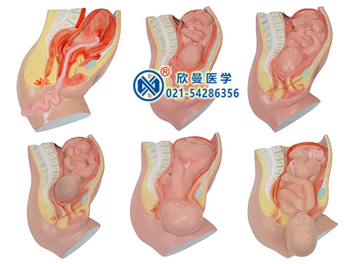 足月胎兒分娩過(guò)程模型