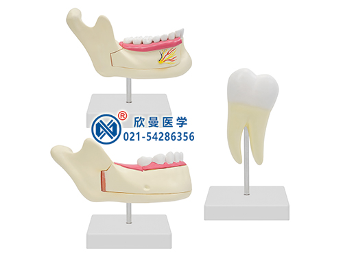 磨牙、乳牙、恒牙模型