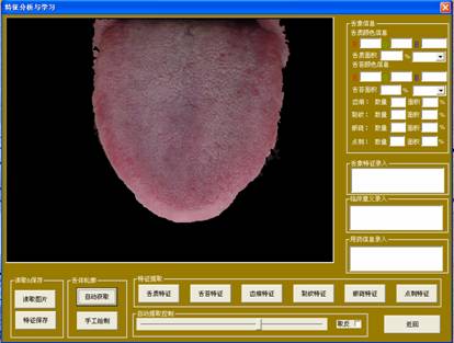 舌像儀自動(dòng)獲取結(jié)果