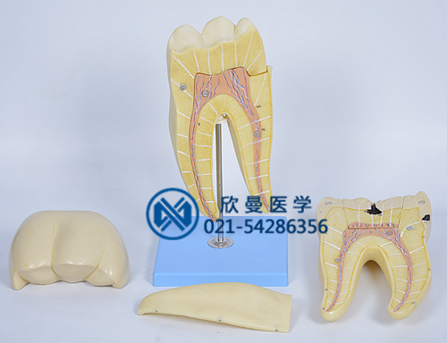 磨牙蛀牙解剖放大模型分解為2部件結(jié)構(gòu)