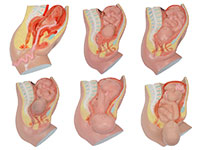 足月胎兒分娩過程模型（6部件）